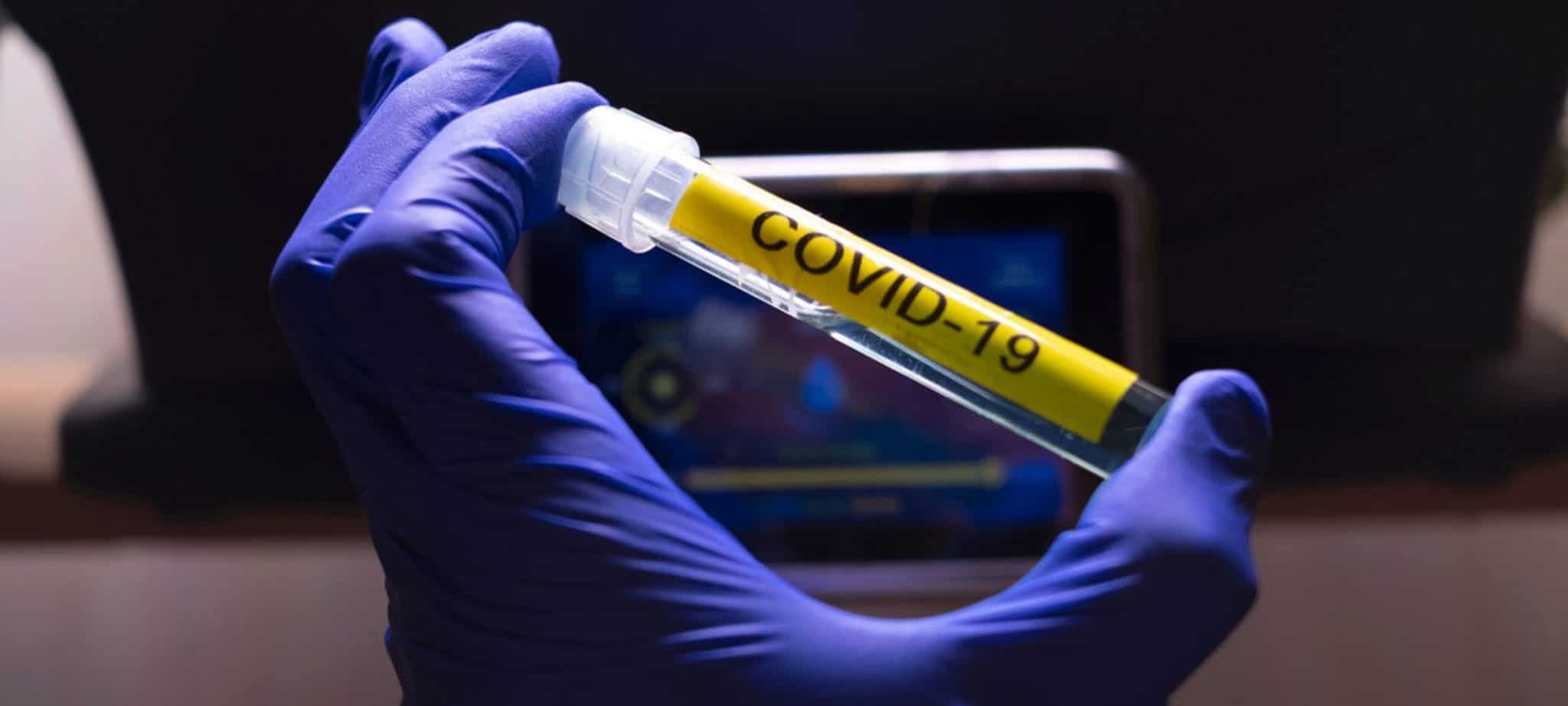 Coronavirus: how many people die per day in the world