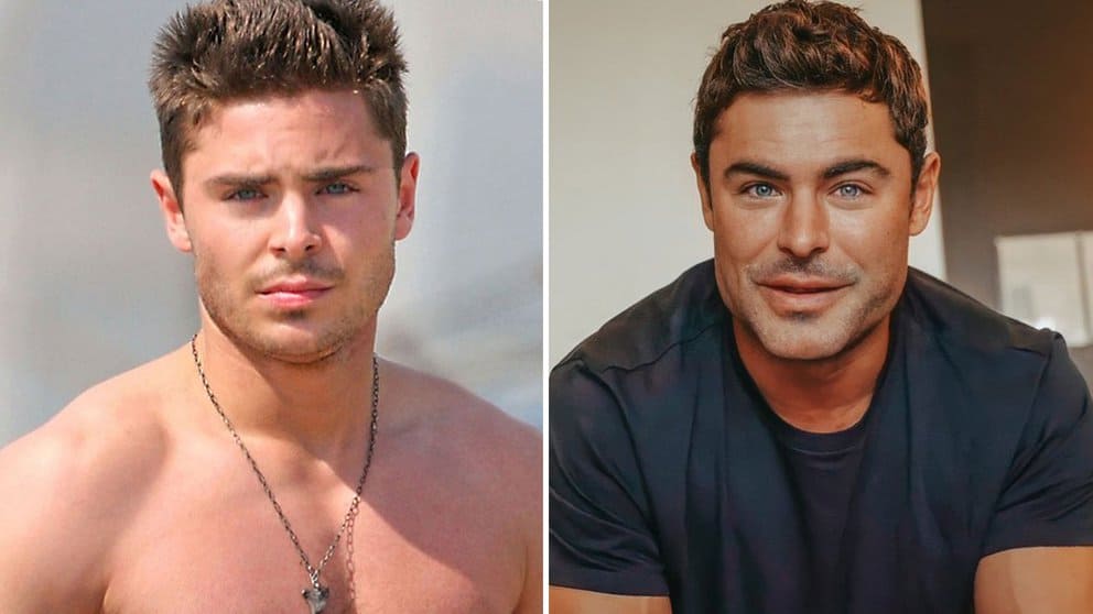I M Going To Sue The Plastic Surgeon Zac Efron S New Face Sparked Mockery And Criticism