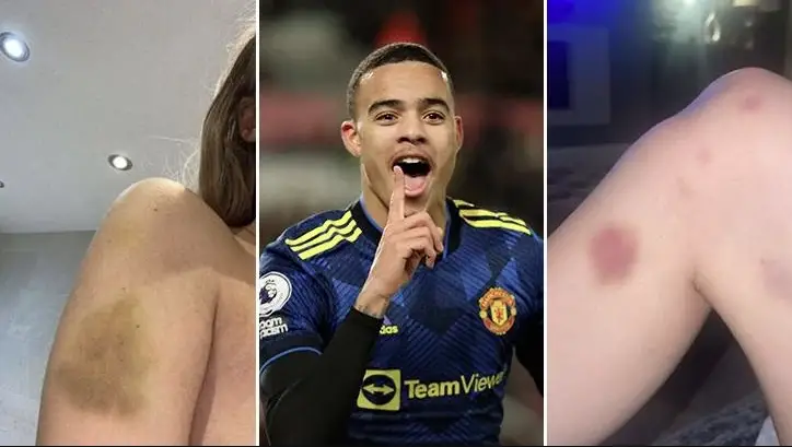 Harriet Robson Shared Photos & Videos Of Her Boyfriend Trying To Rape Her